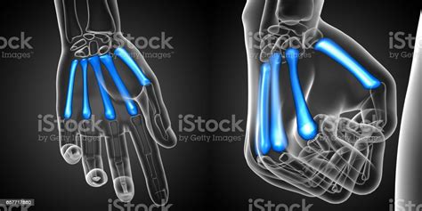 3d Rendering Medical Illustration Of The Metacarpal Bone Stock Photo