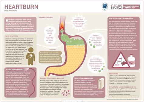 Heartburn Explained Infographic Best Infographics