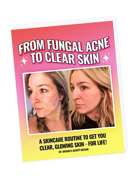 Fungal Acne Safe Moisturizers Brookes Beauty Bazaar