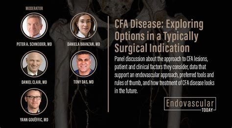 Panel Discussion Cfa Disease Exploring Options In A Typically