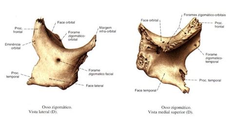 viscerocranio zigomatico maxila mandibula palatino nasal vômer Dentist Art Moose Art