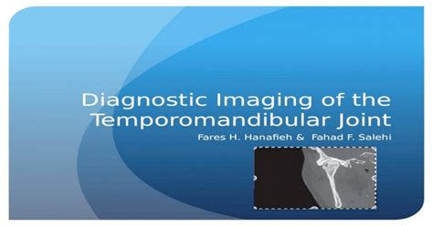 Radiographic Imaging Of Tmj Pptx Powerpoint