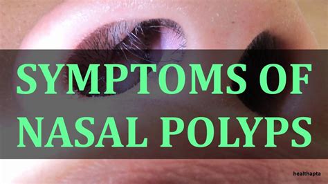 Symptoms Of Nasal Polyps Youtube
