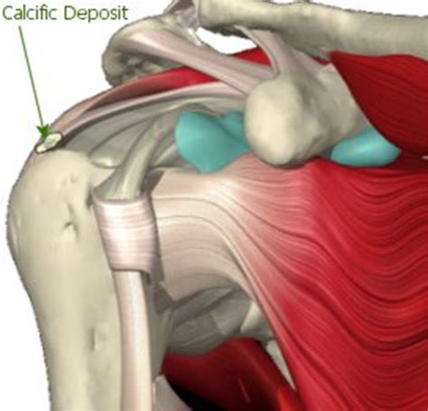 Shoulder Tendon Anatomy In This Article We Shall Look At The Anatomy Of The Shoulder Joint