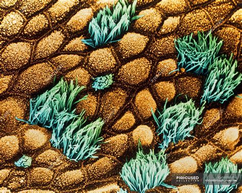 Coloured Scanning Electron Micrograph Sem Of Epithelial Cells Lining
