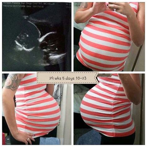 Triple Bump With Ultrasound Baby Bumps Bump