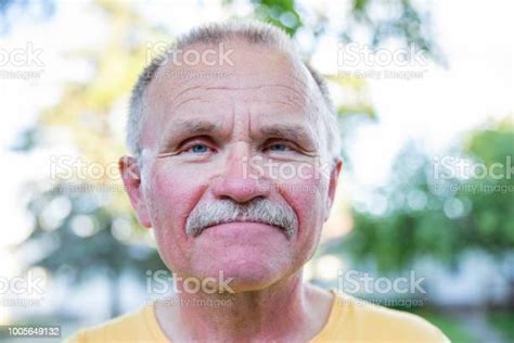 Head Shot Of Man With Sun Burn On His Face Stock Photo Download Image