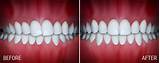 Orthodontics Silver Spring