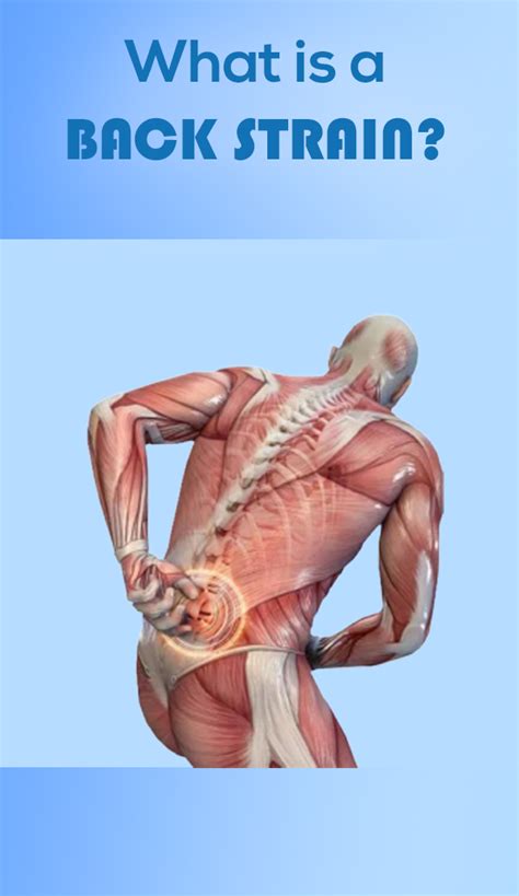 A Muscle Strain Pulled Muscle Or Even Back Strain Occurs When Your Muscle Or Its Tendons Are