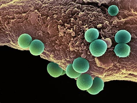 Mengenal Bakteri Staphylococcus Aureus Yang Resisten Dan Sensitif Metisilin Serta Respon