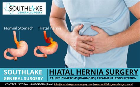 Types Of Hiatal Hernia Surgery