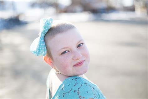Bald Is Beautiful Childhood Cancer Inspiration Photoshoot Kylee Ann