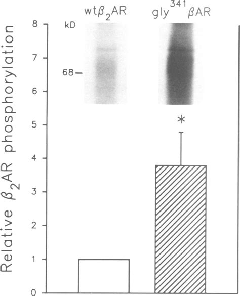 Basal Phosphorylation Level Of Wti Ar And Gly Ar Gly F Ar