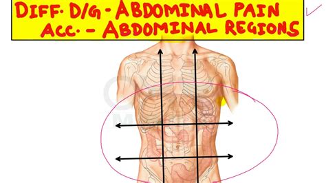 Differential Diagnosis Of Abdominal Pain Youtube