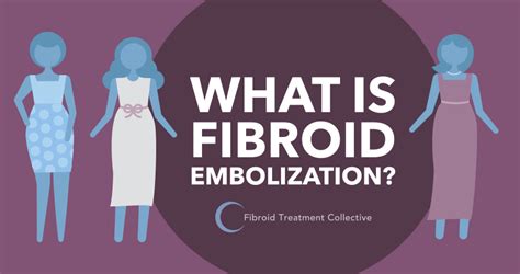 Uterine Fibroid Embolization Treatment Explained In Infographic