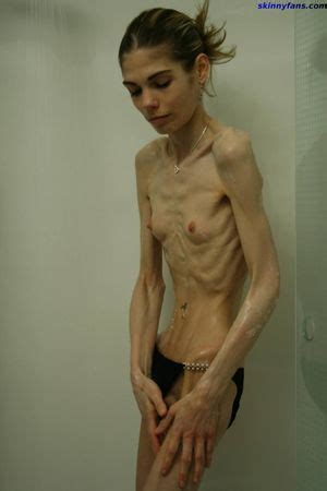 Anorexic Nudes