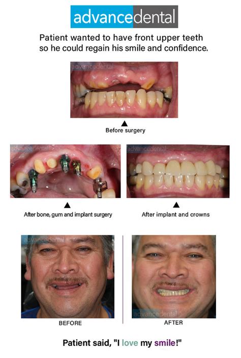 Case Studies Advance Dental