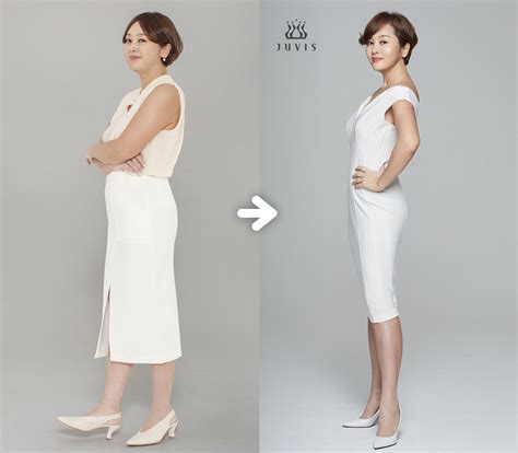 갑상선 기능 저하증 앓던 이승연 두 달만에 9kg 감량 성공