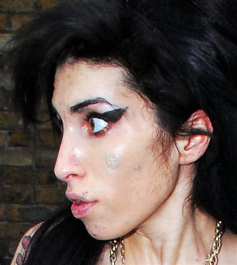 Heavy Make Up Fails To Conceal The State Of Amy Winehouses