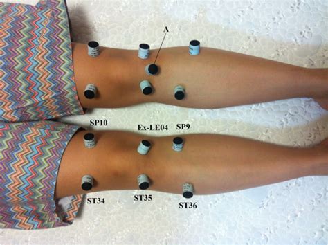Acupuncture Points Of Treatment The Right Knee Will Be Treated At 6