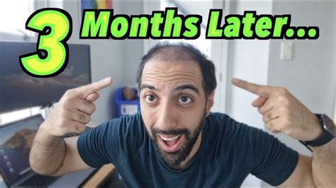 Month Hair Transplant Update From Turkey Grafts Fue Youtube