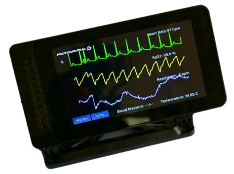 Remote Patient Monitoring? Now It's Possible! - Open Electronics - Open Electronics