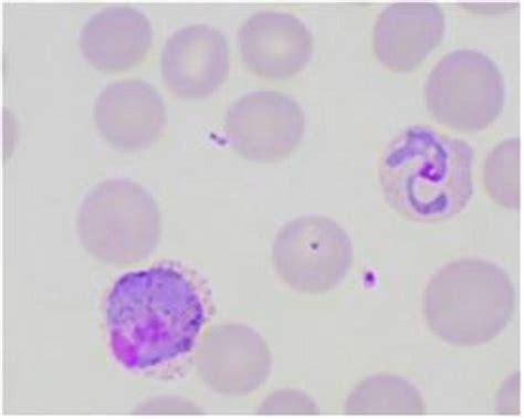 Malaria Detection And Identification