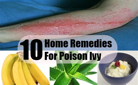 Poison Ivy Home Remedies Natural Treatments And Cures Search Home Remedy