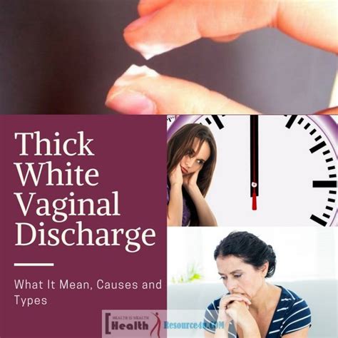 thick white discharge instead of period how to control vaginal discharge 10 steps with