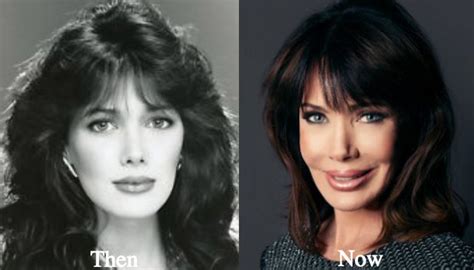 hunter tylo plastic surgery before and after photos latest plastic