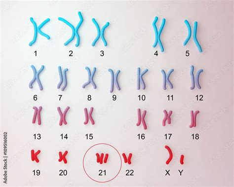 Down Syndrome Karyotype Male Labeled Trisomy 21 3d Illustration Illustration Stock Adobe Stock