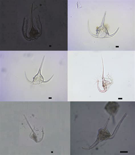 Light micrographs of the genus Tripos. (a) T. platycornis var. cuneatus ...