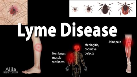 Lyme Disease Animation Youtube