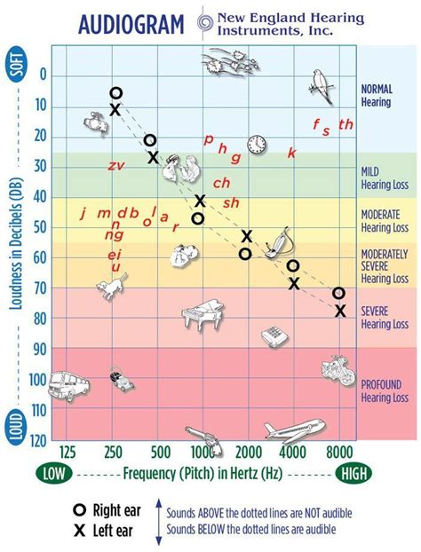 Learn how speech therapy for adults can help with communication issues caused by hearing loss. Audiogram use to chart hearing loss. It's good to have ...