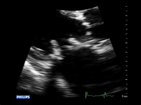 Ase 3d Echocardiography Library