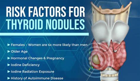 These Are The Risk Factors For Thyroid Nodules Medizzy