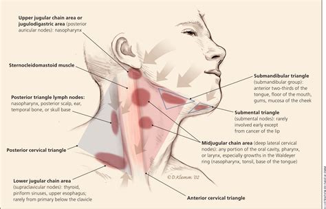 Submandibular Lymph Node Pain Causes