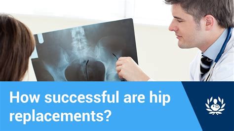 How Successful Are Hip Replacements Youtube