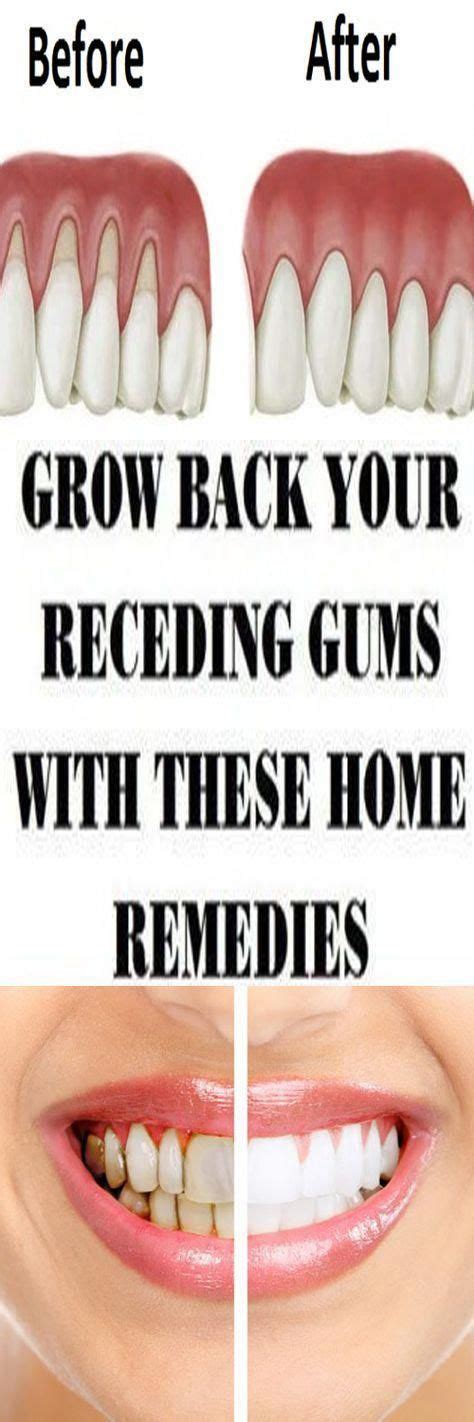 Do You Have A Problem With Receding Gums And You Dont Have Solution