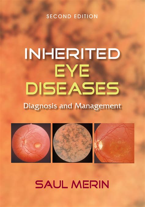 Inherited Eye Diseases Diagnosis And Management 2nd Edition Saul