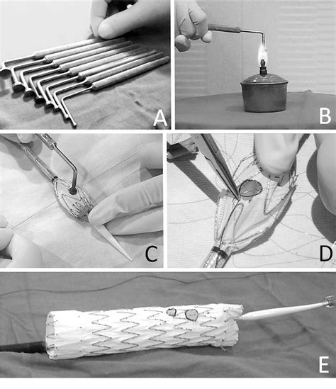 Figure 1 From A Novel Cautery Instrument For On Site Fenestration Of