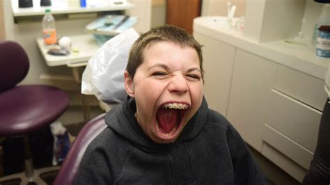 14 годишно момче от САЩ постави световен рекорд за най голямата уста в света видео