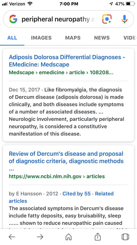 Pin By Julieh6162 On Dercums Disease And Lipedema Fibromyalgia