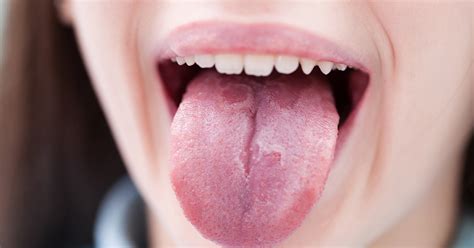 Why Is Your Tongue White Doctors Talk About The Causes