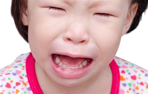 Canker Sores Causes And Treatment The Kidds Place