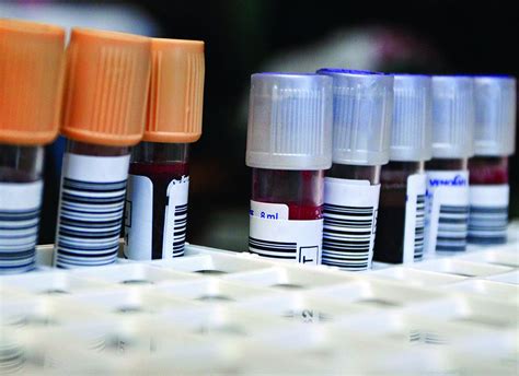 Repeat Blood Cultures Not Useful In Treating Gram Negative Bacteremia