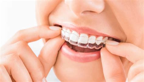 Invisalign Vs Braces Essential Dental Health