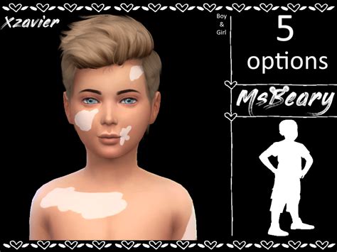 Sims 4 Vitiligo Skin Detail Jesspider