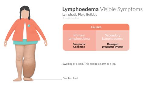 Lymphoedema And Fluid Retention Lymph Info Trust