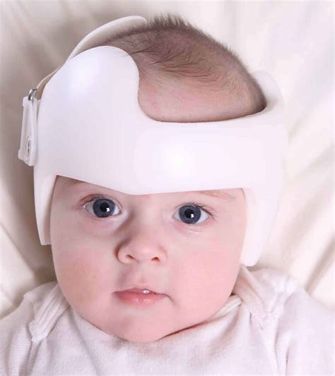 Flat Head Syndrome Helmet